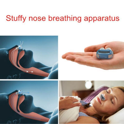Anti-Snoring Device