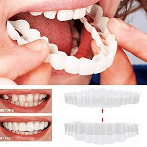 PerfectSmile™ Braces