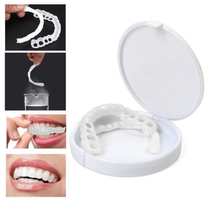 PerfectSmile™ Braces